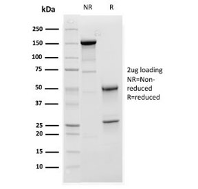 SDS-PAGE analysis of purified, BSA-free Complement C1q A-Chain antibody (clone C1QA/2952) as confirmation of integrity and purity.