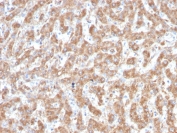 IHC staining of FFPE human liver with Complement C1q A-Chain antibody (clone C1QA/2952). HIER: boil tissue sections in pH 9 10mM Tris with 1mM EDTA for 10-20 min and allow to cool before testing.
