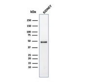 Western blot testing of human kidney tissue lysate with recombinant CD137 antibody. Expected molecular weight: ~30 kDa monomer and 55-60 kDa dimer. Higher molecular weights may be observed due to glycosylation.