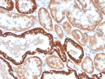 IHC staining of FFPE human kidney with CD137 antibody (clone 4-1BB/4552R). HIER: boil tissue sections in pH9 10mM Tris with 1mM EDTA for 10-20 min and allow to cool before testing.~