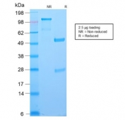 SDS-PAGE analysis of purified, BSA-free recombinant Bcl6 antibody (clone BCL6/2497R) as confirmation of integrity and purity.