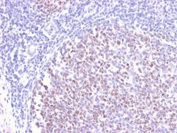IHC staining of FFPE human tonsil with recombinant Bcl6 antibody (clone BCL6/2497R). HIER: boil tissue sections in pH 9 10mM Tris with 1mM EDTA for 20 min and allow to cool before testing.~