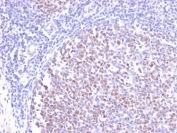 IHC staining of FFPE human tonsil with recombinant Bcl6 antibody (clone BCL6/2497R). HIER: boil tissue sections in pH 9 10mM Tris with 1mM EDTA for 20 min and allow to cool before testing.