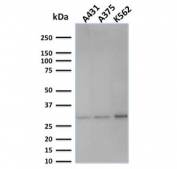 Western blot testing of human samples with Replication Protein A2 antibody (clone SPM316). Expected molecular weight ~32 kDa.