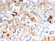 IHC testing of FFPE human placenta with FSP1 antibody (clone rS100A4/1481). Required HIER: steam sections in pH 9 10mM Tris with 1mM EDTA for 10-20 min followed by cooling.