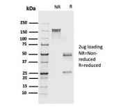 SDS-PAGE analysis of purified, BSA-free recombinant FSP1 antibody (clone rS100A4/1481) as confirmation of integrity and purity.