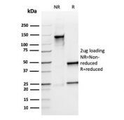 SDS-PAGE analysis of purified, BSA-free recombinant S100A9 antibody (clone rMAC3781) as confirmation of integrity and purity.