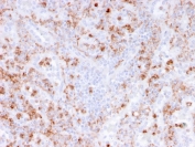 IHC staining of FFPE human spleen with recombinant S100A9 antibody (clone rMAC3781). HIER: boil tissue sections in pH 9 10mM Tris with 1mM EDTA for 20 min and allow to cool before testing.