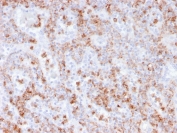 IHC staining of FFPE human spleen with recombinant S100A9 antibody (clone rMAC3781). HIER: boil tissue sections in pH 9 10mM Tris with 1mM EDTA for 20 min and allow to cool before testing.