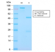 SDS-PAGE analysis of purified, BSA-free recombinant S100A9 + Calprotectin antibody (clone MAC3157R) as confirmation of integrity and purity.