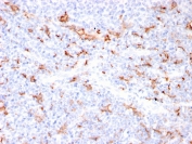 IHC staining of FFPE human tonsil with recombinant S100A9 + Calprotectin antibody (clone MAC3157R). HIER: boil tissue sections in pH 9 10mM Tris with 1mM EDTA for 20 min and allow to cool before testing.
