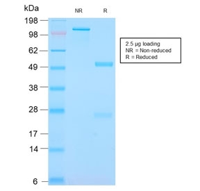SDS-PAGE analysis of purified, BSA-free recombinant S100A9 + Calprotectin antibody (clone MAC3157R) as confirmation of integrity and purity.