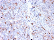 IHC staining of FFPE human tonsil with recombinant S100A9 + Calprotectin antibody (clone MAC3157R). HIER: boil tissue sections in pH 9 10mM Tris with 1mM EDTA for 20 min and allow to cool before testing.