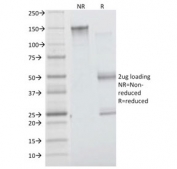 SDS-PAGE analysis of purified, BSA-free Insulin Receptor alpha antibody (clone INSR/1661) as confirmation of integrity and purity.