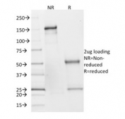 SDS-PAGE analysis of purified, BSA-free SDHB antibody (clone SDHB/2382) as confirmation of integrity and purity.