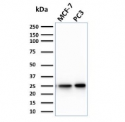 Western blot testing of human MCF7 and PC3 cell lysate with CHP2 antibody (clone CPTC-CHP2-1). Predicted molecular weight ~22 kDa.