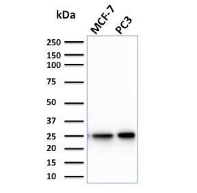 Western blot testing of human MCF7 and PC3 cell lysate with CHP2 antibody. Predicted molecular weight ~22 kDa.