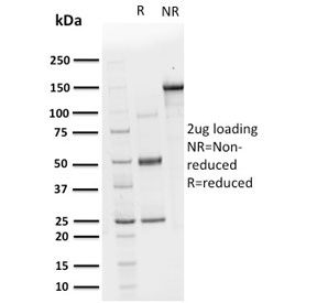 SDS-PAGE analysis of purified, BSA-free CHP2 antibody as confirmation of integrity and purity.