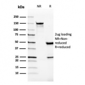 SDS-PAGE analysis of purified, BSA-free VISTA antibody (clone VISTA/2865) as confirmation of integrity and purity.