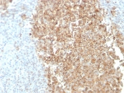 IHC staining of FFPE human spleen with CDw75 antibody (clone ZB55). HIER: boil tissue sections in pH 9 10mM Tris with 1mM EDTA for 20 min and allow to cool before testing.