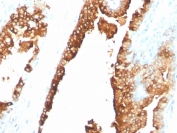 IHC staining of FFPE human spleen with CDw75 antibody (clone ZB55). HIER: boil tissue sections in pH 9 10mM Tris with 1mM EDTA for 20 min and allow to cool before testing.