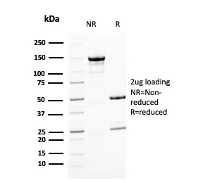 SDS-PAGE analysis of purified, BSA-free BMI1 antibody as confirmation of integrity and purity.