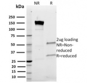 SDS-PAGE analysis of purified, BSA-free Band 3 antibody (clone Q1/156) as confirmation of integrity and purity.