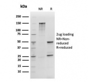 SDS-PAGE analysis of purified, BSA-free recombinant SOX2 antibody (clone rSOX2/1792) as confirmation of integrity and purity.