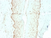 IHC staining of FFPE human cervix with recombinant SOX2 antibody (clone rSOX2/1792). HIER: boil tissue sections in pH 9 10mM Tris with 1mM EDTA for 10-20 min and allow to cool before testing.