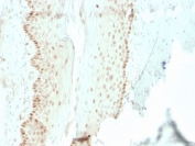 IHC staining of FFPE human cervix with recombinant SOX2 antibody (clone rSOX2/1792). HIER: boil tissue sections in pH 9 10mM Tris with 1mM EDTA for 10-20 min and allow to cool before testing.