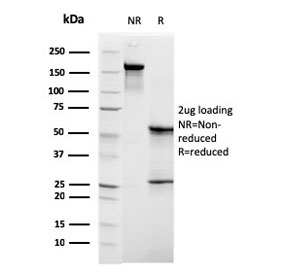 SDS-PAGE analysis of purified, BSA-free C1QB antibody as confirmation of integrity and purity.