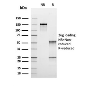 SDS-PAGE analysis of purified, BSA-free Complement C1q B-Chain antibody as confirmation of integrity and purity.