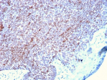 IHC staining of FFPE human skin with p73 antibody. HIER: boil tissue sections in pH 9 10mM Tris with 1mM EDTA for 20 min and allow to cool before testing.~
