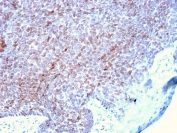 IHC staining of FFPE human skin with p73 antibody (clone P73/2531). HIER: boil tissue sections in pH 9 10mM Tris with 1mM EDTA for 20 min and allow to cool before testing.