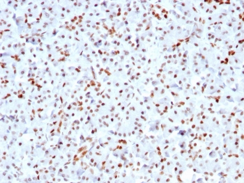 IHC staining of FFPE human pancreas with recombinant SOX9 antibody (clone SOX9/3141R). HIER: boil tissue sections in pH 9 10mM Tris with 1mM EDTA for 10-20 min followed by cooling at RT for 20 min.~