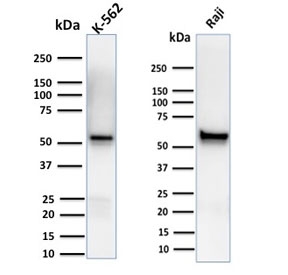 Western blot testing of human K562 and Raji cell lysate with Spastin antibody (clone Sp 6C6). Expected molecular weight: 60-70 kDa.~