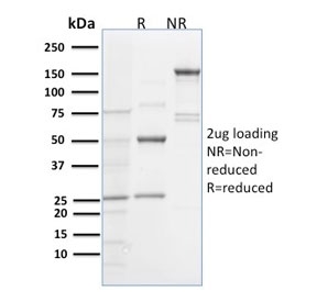 SDS-PAGE analysis of purified, BSA-free Spastin antibody (clone Sp 6C6) as confirmation of integrity and