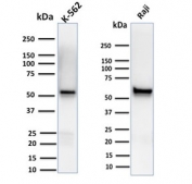 Western blot testing of human K562 and Raji cell lysate with Spastin antibody (clone Sp 6C6). Expected molecular weight: 60-70 kDa.