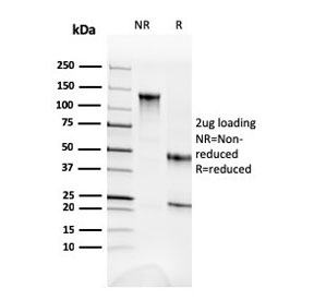 SDS-PAGE analysis of purified, BSA-free Alpha II Spectrin antibody (clone SPTAN1/3352) as confirmation of integrity and purity.