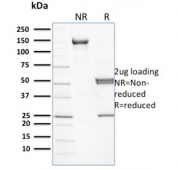 SDS-PAGE analysis of purified, BSA-free SPTB antibody (clone RG/26) as confirmation of integrity and purity.