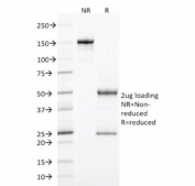 SDS-PAGE analysis of purified, BSA-free StAR antibody (clone STAR/2077) as confirmation of integrity and purity.
