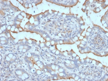 IHC staining of FFPE human stomach with StAR antibody. HIER: boil tissue sections in pH 9 10mM Tris with 1mM EDTA for 20 min and allow to cool before testing.