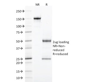 SDS-PAGE analysis of purified, BSA-free StAR antibody as confirmation of integrity and purity.