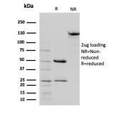 SDS-PAGE analysis of purified, BSA-free STAT5b antibody (clone STAT5B/2657) as confirmation of integrity and purity.