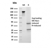 SDS-PAGE analysis of purified, BSA-free Transferrin antibody (clone TF/3001) as confirmation of integrity and purity.