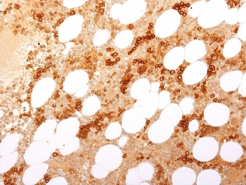 IHC staining of FFPE human bone marrow with recombinant CD71 antibody (clone TFRC/2898R). HIER: boil tissue sections in pH 9 10mM Tris with 1mM EDTA for 20 min and allow to cool before testing.~