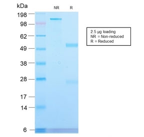 SDS-PAGE analysis of purified, BSA-free re