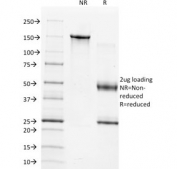SDS-PAGE analysis of purified, BSA-free TIMP1 antibody (clone 2A5) as confirmation of integrity and purity.