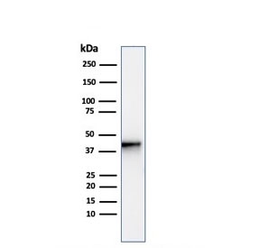 Western blot testing of human kidney lysate with recombinant AMACR antibody. Predicted molecular weight ~43 kDa.