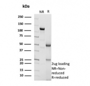SDS-PAGE analysis of purified, BSA-free recombinant AMACR antibody (clone AMACR/4572R) as confirmation of integrity and purity.